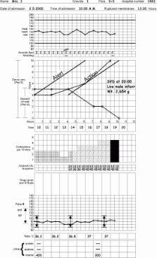 Partogram